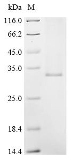 Recombinant Human Very long chain fatty acid elongase 5 (ELOVL5) (CSB-CF882144HU)