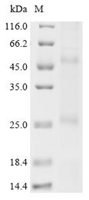 Recombinant Methanobacterium formicicum Probable formate transporter (fdhC) (CSB-CF330494MET)
