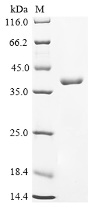 Recombinant Human Butyrophilin-like protein 2 (BTNL2), partial (CSB-YP883443HU)