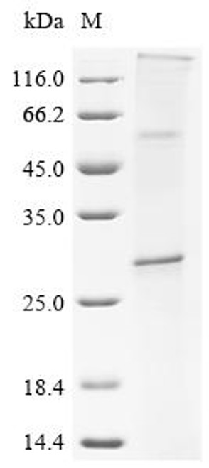 Recombinant Human CD9 antigen (CD9) (CSB-CF004969HU)