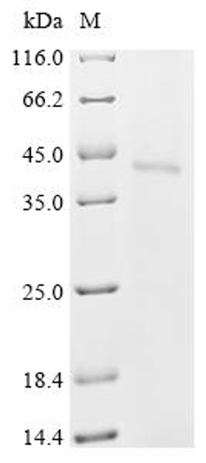 Recombinant Bovine respiratory syncytial virus Major surface glycoprotein G (G) (CSB-CF737465BDAK)