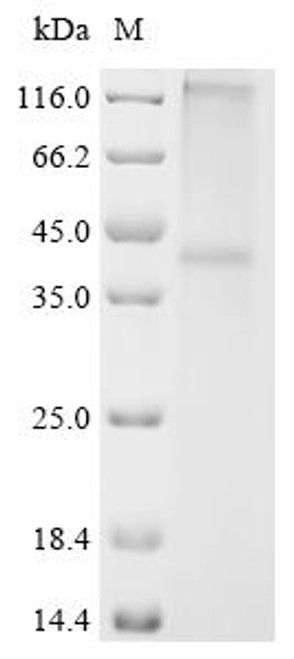 Recombinant Mouse Sphingosine 1-phosphate receptor 2 (S1pr2) (CSB-CF020651MO)
