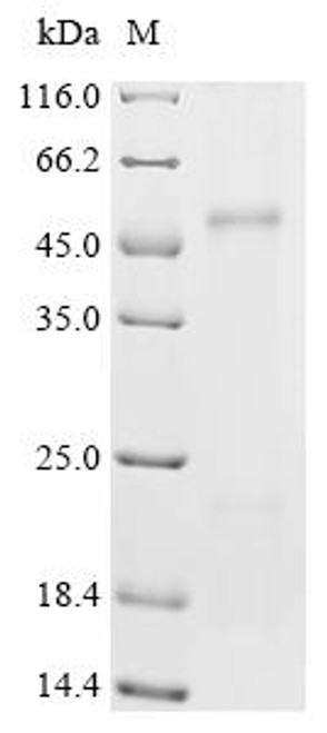 Recombinant Mouse Metal cation symporter ZIP14 (Slc39a14) (CSB-CF748446MO)