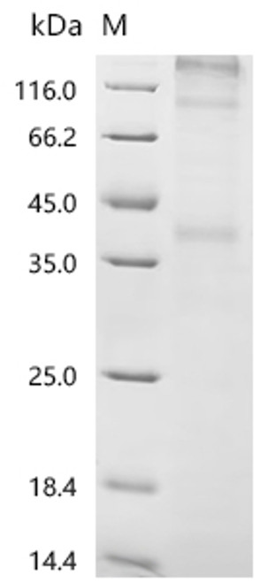 Recombinant Human C-C chemokine receptor type 7 (CCR7) (CSB-CF004846HUa0)