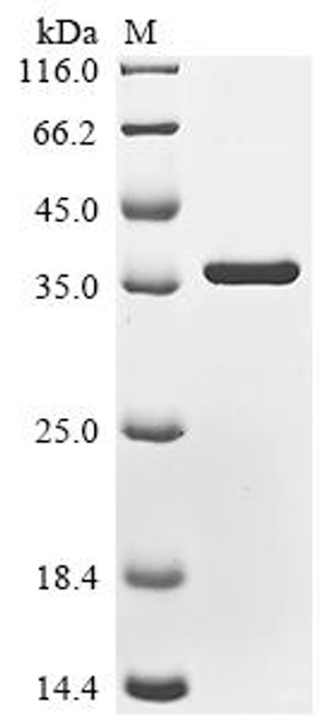 Recombinant Human Protein mono-ADP-ribosyltransferase PARP16 (PARP16), partial (CSB-EP836673HU)