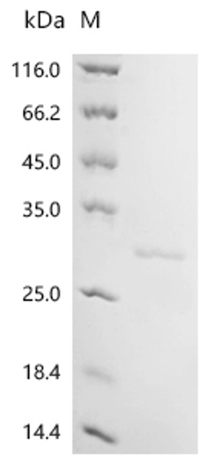 Recombinant Human Myosin regulatory light polypeptide 9 (MYL9) (CSB-EP015318HU)