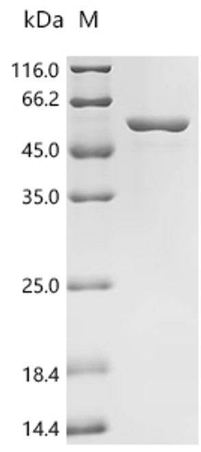 Recombinant Human 26S proteasome non-ATPase regulatory subunit 11 (PSMD11) (CSB-EP018901HU)