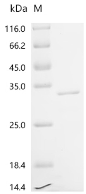 Recombinant Human Mammaglobin-B (SCGB2A1) (CSB-EP020816HUa2)