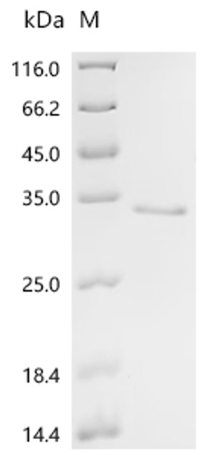 Recombinant Pig Superoxide dismutase [Cu-Zn](SOD1) (CSB-EP022397PIa2)