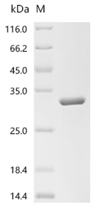 Recombinant Human Hyaluronidase-1 (HYAL1), partial (CSB-EP623651HU1e3)