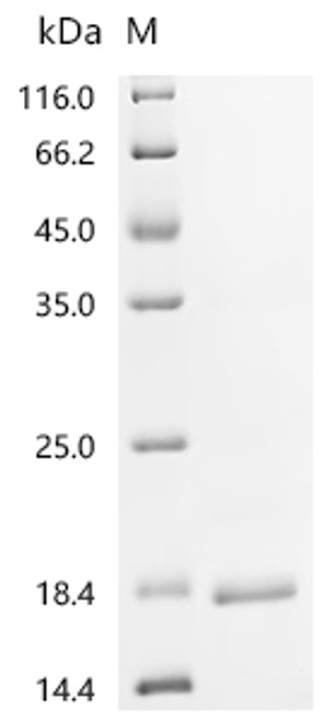 Recombinant Clostridium botulinum Hemagglutinin component of the neurotoxin complex (ha17) (CSB-EP332826CLQf1)