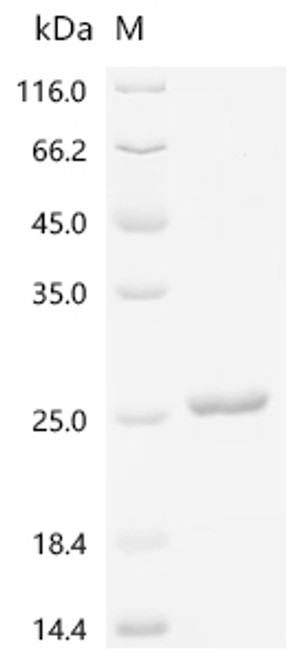 Recombinant Mouse Thyrotropin subunit beta (Tshb), partial (CSB-EP025130MO)