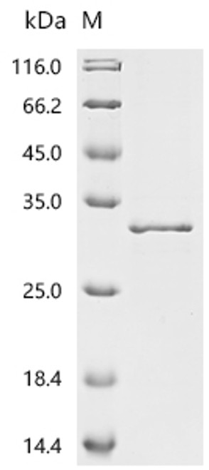 Recombinant Severe acute respiratory syndrome coronavirus 2 Nucleoprotein (N), partial (CSB-EP3325GMY2d7)