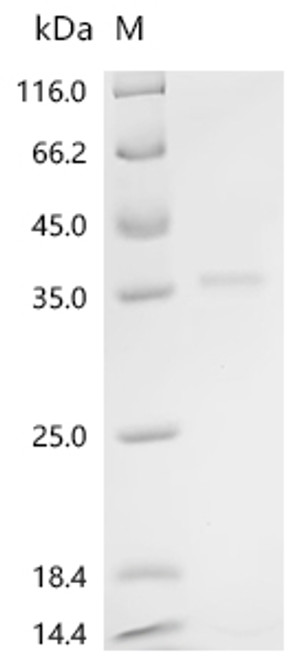 Recombinant Bovine Platelet-derived growth factor subunit B (PDGFB), partial (CSB-EP017709BO1n6)