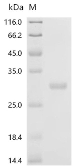 Recombinant Mouse Prolactin (Prl) (CSB-EP018724MOa0)