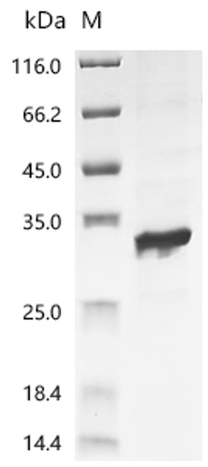 Recombinant Escherichia phage T7 T7 RNA polymerase (1), partial (CSB-EP018353EEBa2)