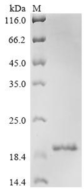 Recombinant Human Contactin-associated protein-like 2 (CNTNAP2), partial (CSB-EP887030HU)