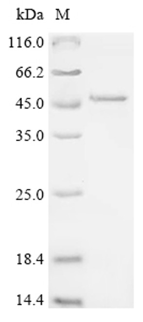 Recombinant Human Endophilin-B1 (SH3GLB1) (CSB-EP878084HUc7)