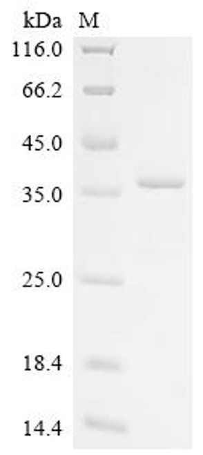Recombinant Pinctada fucata Mantle gene 8 (CSB-EP5199GQA)