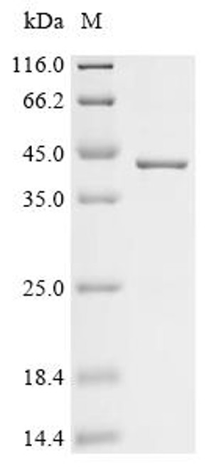 Recombinant African swine fever virus B646L (p72), partial (CSB-EP3311GMW1)