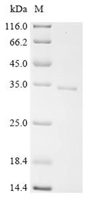 Recombinant Human Regulator of G-protein signaling 16 (RGS16) (CSB-EP019647HU)