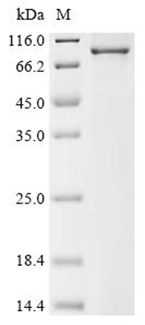 Recombinant Human Keratin,type II cytoskeletal 6A (KRT6A) (CSB-EP012561HUf0)