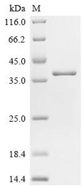 Recombinant Human Charged multivesicular body protein 2b (CHMP2B) (CSB-EP891990HUc7)