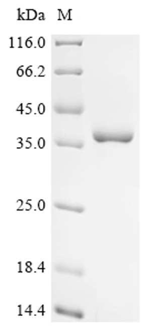 Recombinant Human U1 small nuclear ribonucleoprotein A (SNRPA), partial (CSB-EP022327HU1c7)