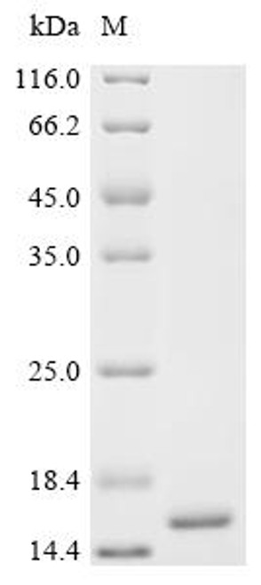 Recombinant Shigella flexneri Arginine ABC transporter permease protein ArtM (artM), partial (CSB-EP365079SZB1)