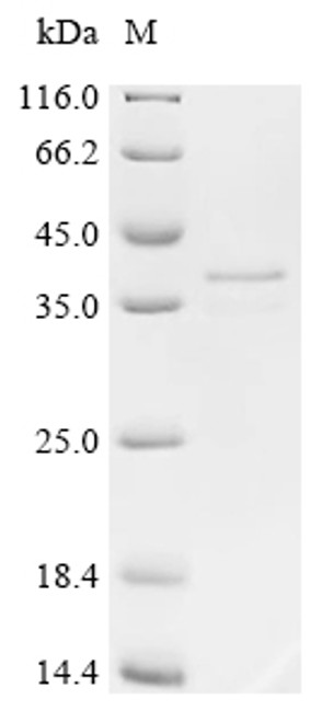 Recombinant Human STEAP1 protein (STEAP1), partial (CSB-EP890691HU)