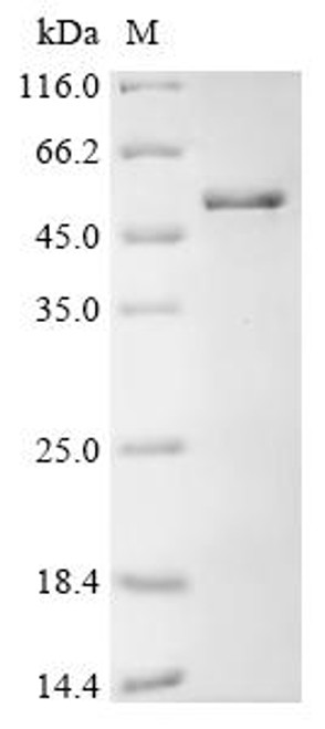 Recombinant Mouse Slit homolog 2 protein (Slit2), partial (CSB-EP879505MO)