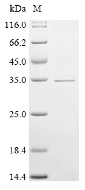 Recombinant Human Protein GAPT (GAPT), partial (CSB-EP839783HU1a2)