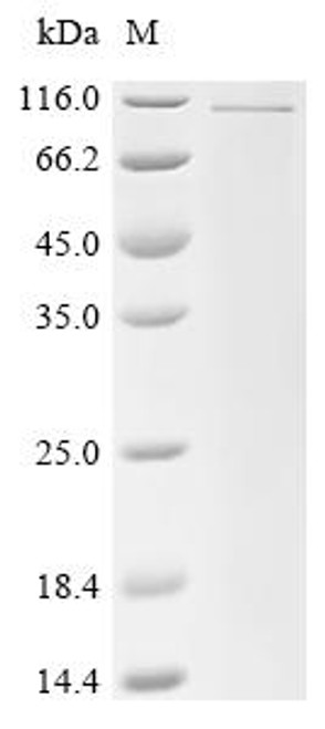 Recombinant Human Fibulin-1 (FBLN1) (CSB-EP008452HU)
