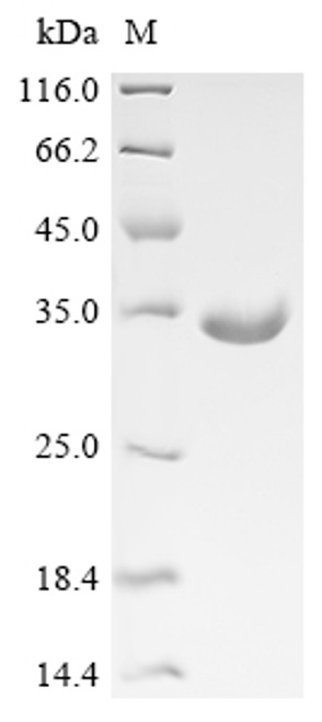 Recombinant Human Nucleolar protein 3 (NOL3) (CSB-EP015921HUc7)