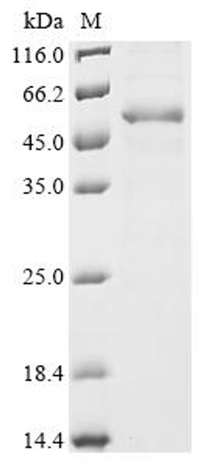 Recombinant Human Androgen receptor (AR) , partial (CSB-EP001975HU4)