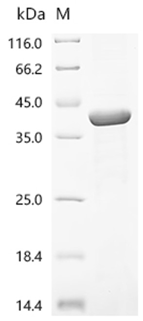 Recombinant Epstein-Barr virus Envelope glycoprotein L (gL) (CSB-EP355982EFAc0)