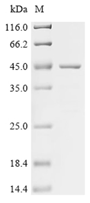 Recombinant Human SPARC-related modular calcium-binding protein 1(SMOC1), partial (CSB-EP875673HU1f0)