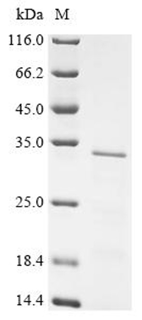 Recombinant Human Protein L-Myc (MYCL), partial (CSB-EP015274HU1)