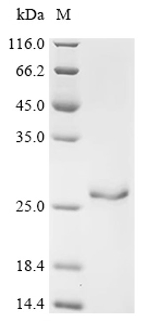 Recombinant Human Small ribosomal subunit protein eS25 (RPS25) (CSB-EP020406HUc7)