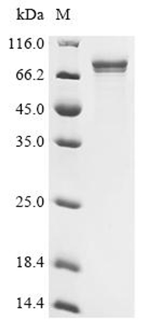 Recombinant Human Lysine-specific demethylase RSBN1L (RSBN1L), partial (CSB-EP757620HU)
