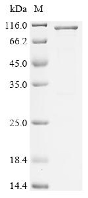 Recombinant Human FYVE, RhoGEF and PH domain-containing protein 3 (FGD3) (CSB-EP689335HU) Recombinant Human FYVE, RhoGEF and PH domain-containing protein 3 (FGD3) (CSB-EP689335HU)