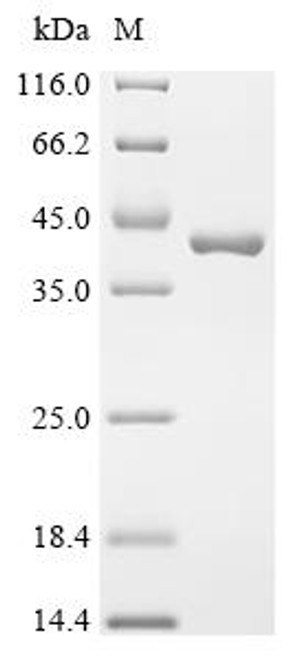 Recombinant Shigella flexneri Virulence sensor protein PhoQ (phoQ), partial (CSB-EP802867SZB1) Recombinant Shigella flexneri Virulence sensor protein PhoQ (phoQ), partial (CSB-EP802867SZB1)