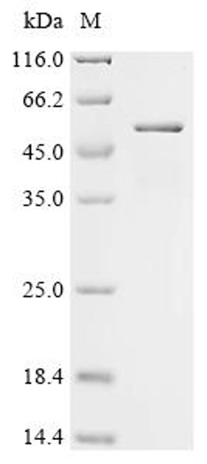 Recombinant Mouse Receptor-type tyrosine-protein phosphatase-like N (Ptprn), partial (CSB-EP730645MO) Recombinant Mouse Receptor-type tyrosine-protein phosphatase-like N (Ptprn), partial (CSB-EP730645MO)