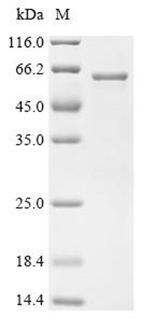 Recombinant Human Transcriptional regulator ERG (ERG) (Δ239-245) (CSB-EP007781HU(M)) Recombinant Human Transcriptional regulator ERG (ERG) (Δ239-245) (CSB-EP007781HU(M))