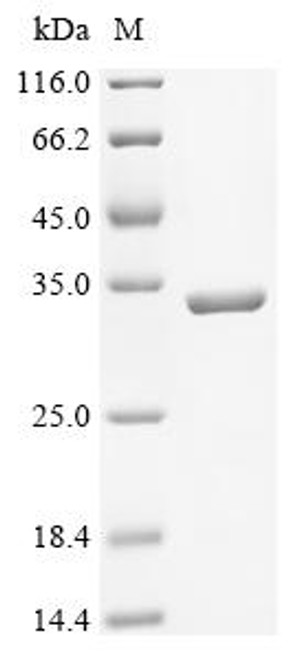 Recombinant Enterobacteria phage T4 Sliding clamp (45) (CSB-EP361288EDZ) Recombinant Enterobacteria phage T4 Sliding clamp (45) (CSB-EP361288EDZ)