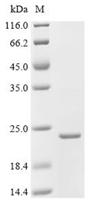 Recombinant Bacillus phage phi29 Single-stranded DNA-binding protein (5) (CSB-EP654323BBC)