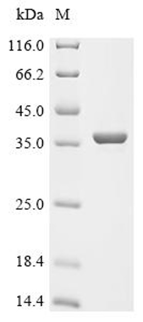 Recombinant Shigella flexneri Nucleoside-specific channel-forming protein tsx (tsx) (CSB-EP359235SZB) Recombinant Shigella flexneri Nucleoside-specific channel-forming protein tsx (tsx) (CSB-EP359235SZB)