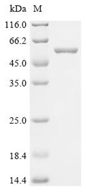 Recombinant Glutamicibacter nicotianae Adenylate cyclase (cya) (CSB-EP326731BLY) Recombinant Glutamicibacter nicotianae Adenylate cyclase (cya) (CSB-EP326731BLY)