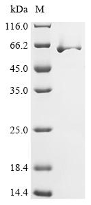 Recombinant Vaccinia virus Protein OPG154 (OPG154), Biotinylated (CSB-EP318120VAI-B) Recombinant Vaccinia virus Protein OPG154 (OPG154), Biotinylated (CSB-EP318120VAI-B)