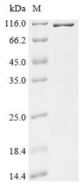 Recombinant Human RNA cytosine C(5)-methyltransferase NSUN2 (NSUN2) (CSB-EP626626HU)